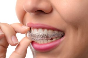 When to Start Adult Orthodontic Treatment