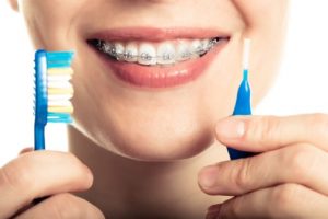 6 Ways to Keep Teeth Clean with Braces
