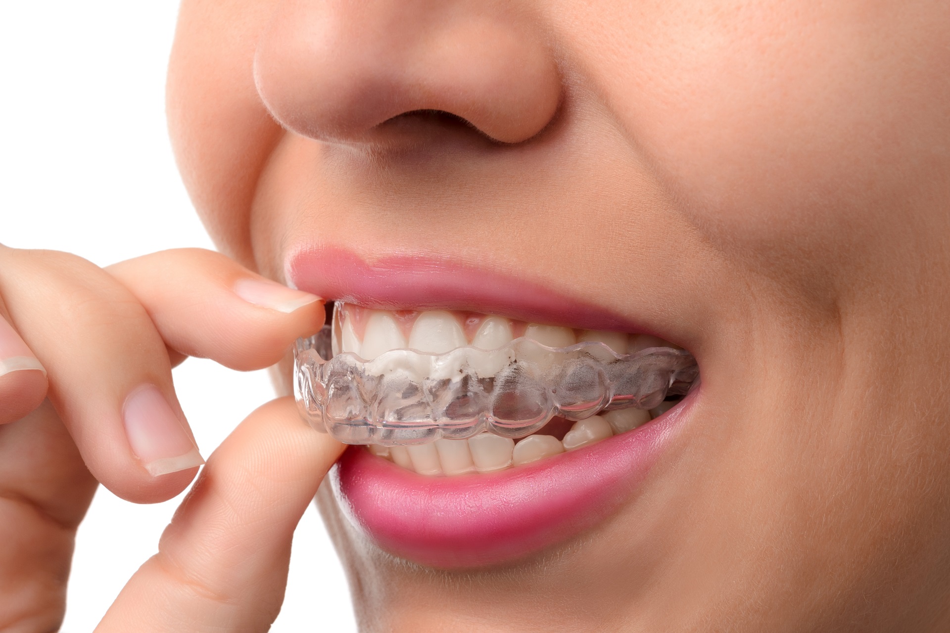 When to Start Adult Orthodontic Treatment | Dr. L&#39;Tanya Joy Bailey, DDS